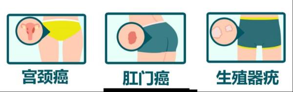 为什么男性要接种HPV疫苗？（2）